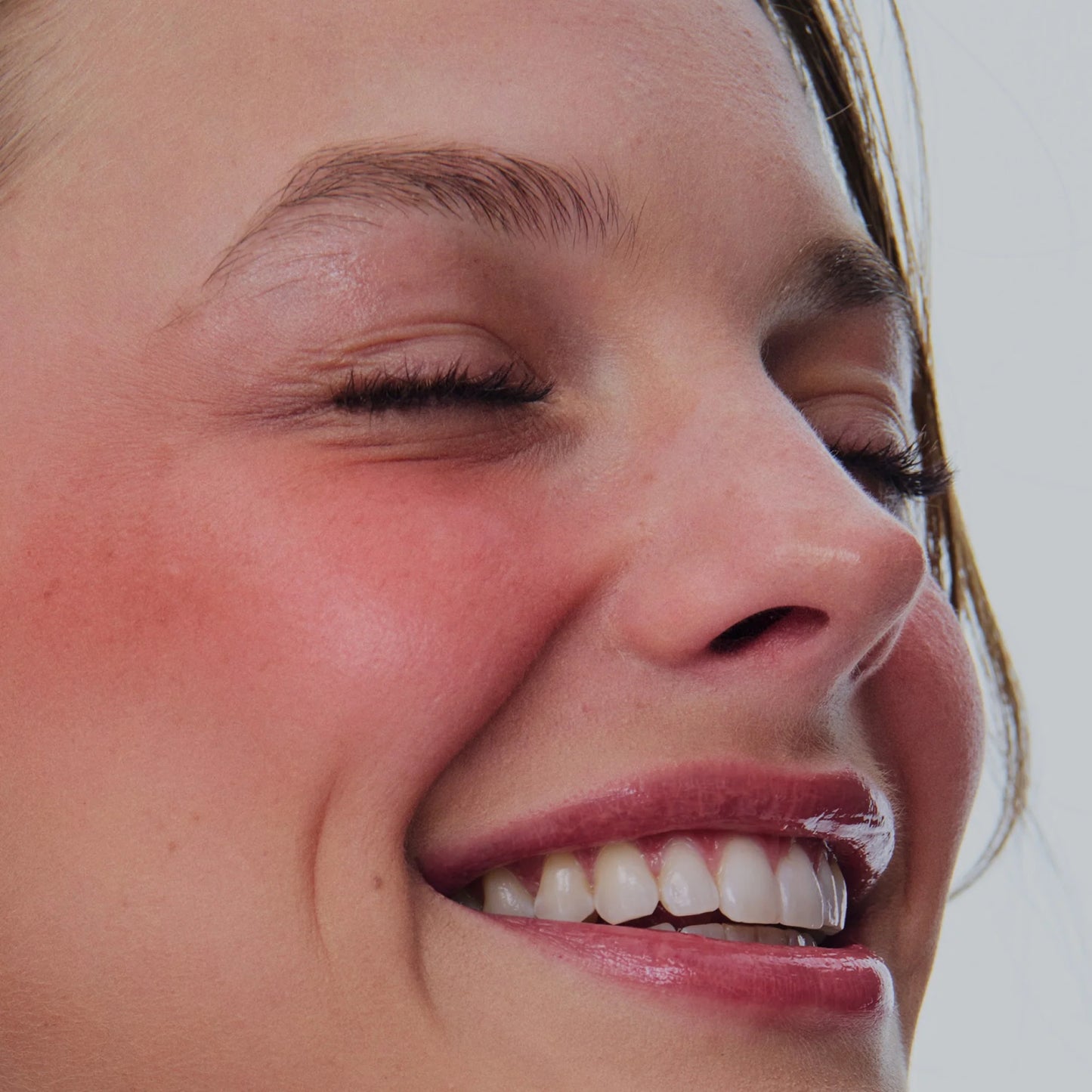 freckle