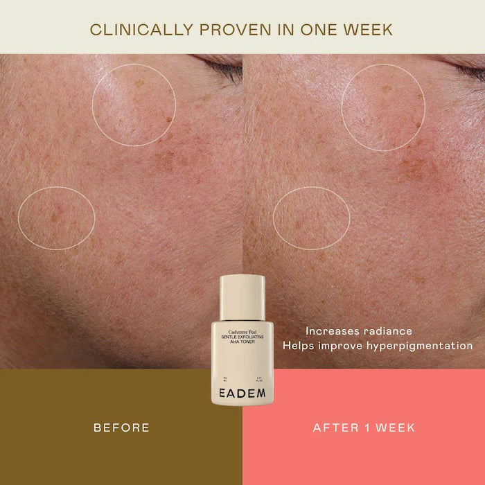EADEM 
Cashmere Peel Milky Exfoliant & Hydrating Essence