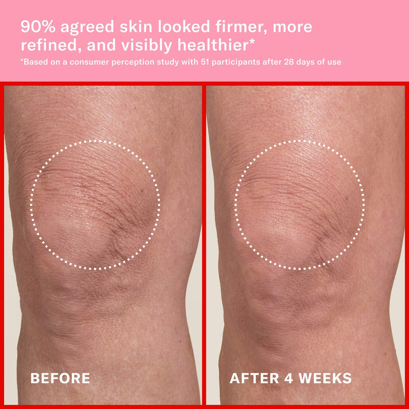Mini Pink Algae Pro-Retinol Body Butter for Anti-Aging and KP