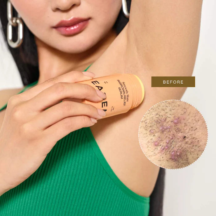 EADEM 
Smooth Slate Ingrown Hair and Dark Spot Serum