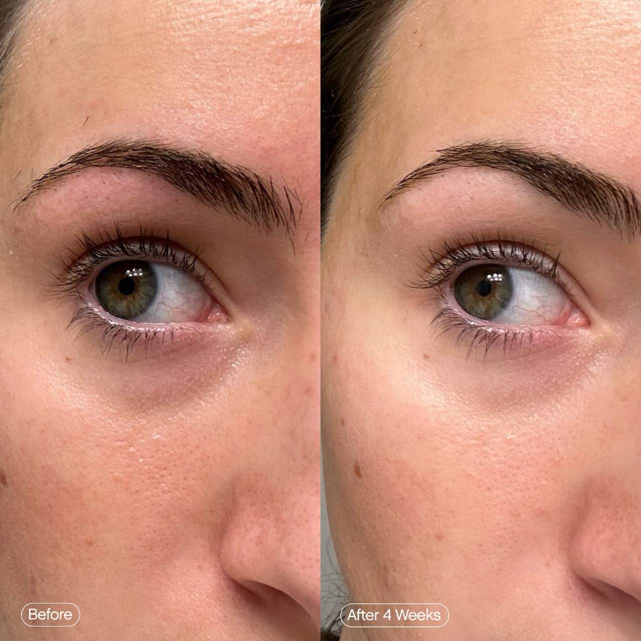 Topicals 
Faded Under Eye Brightening & Clearing Eye Masks