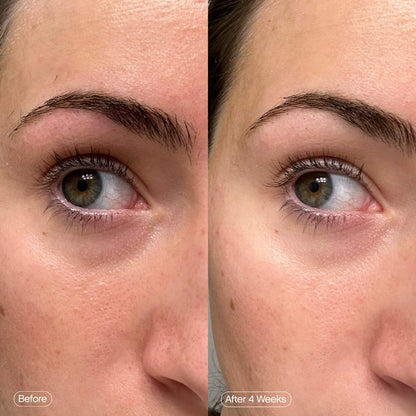 Topicals 
Faded Under Eye Brightening & Clearing Eye Masks
