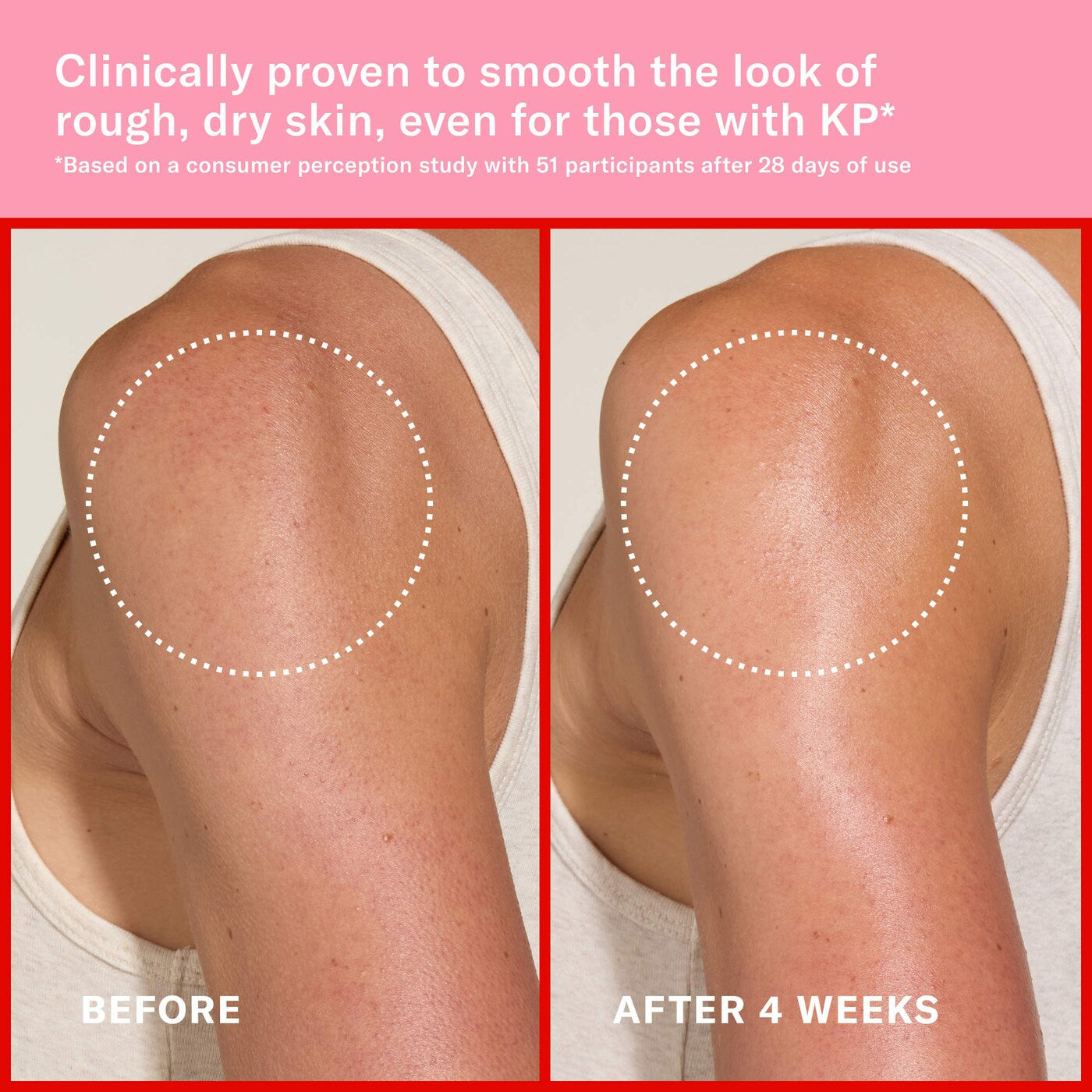 Mini Pink Algae Pro-Retinol Body Butter for Anti-Aging and KP