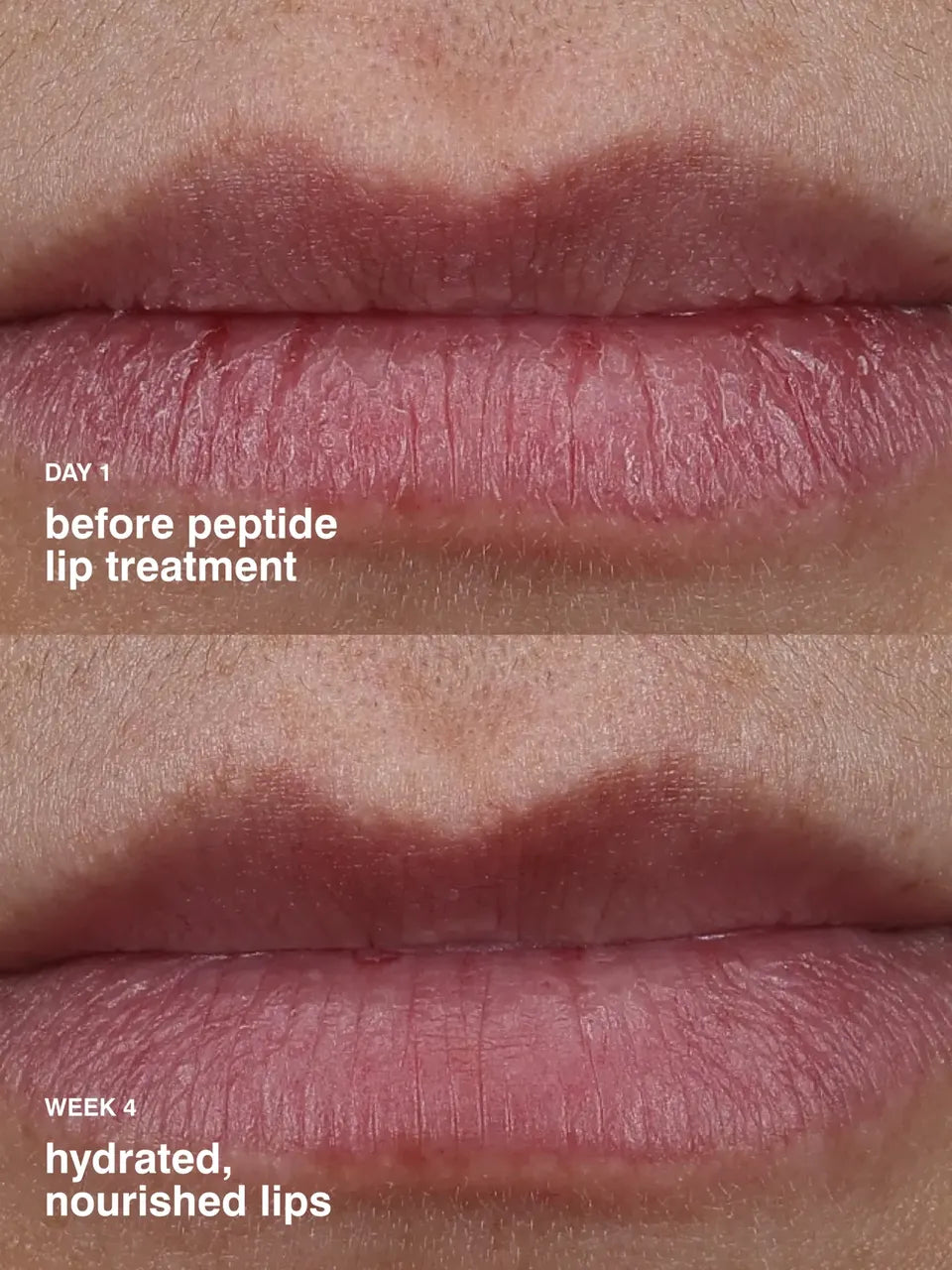 Sugarberry Lip Treatment