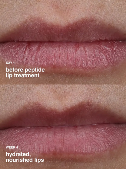 Sugarberry Lip Treatment