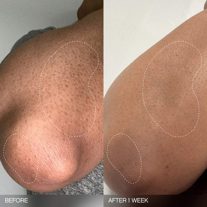 Topicals 
Slather Exfoliating & Smoothing Bar - For Soft Skin