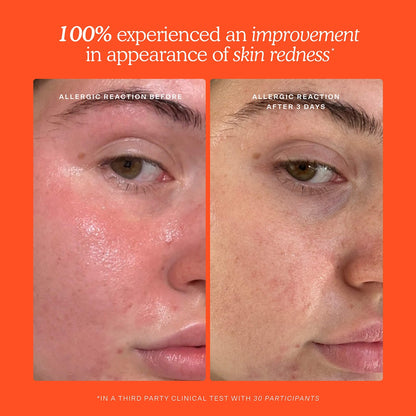 SOS Daily Rescue Facial Spray with Hypochlorous Acid