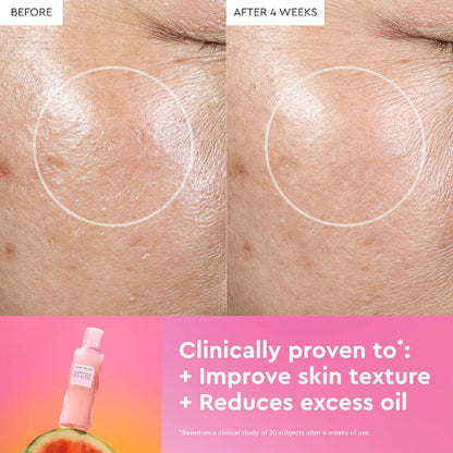 Glow Recipe 
Watermelon Glow PHA + BHA Pore-Tight Toner