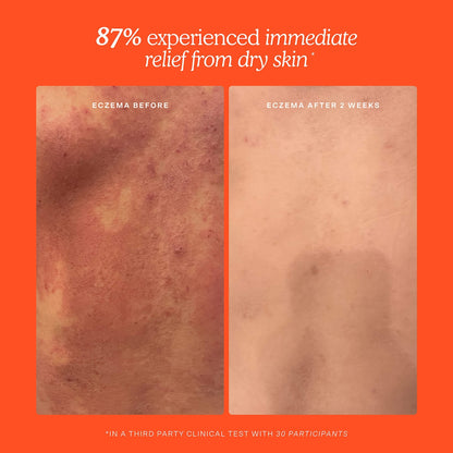 SOS Daily Rescue Facial Spray with Hypochlorous Acid