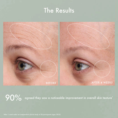 Summer Fridays 
Gentle Reset Daily Exfoliating Pads to Smooth + Minimize Pores with AHAs